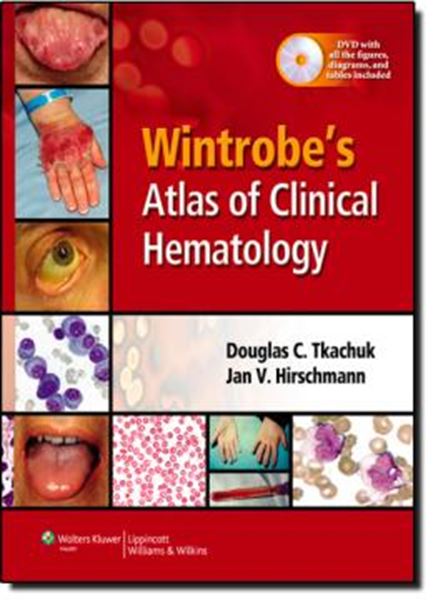 Picture of WINTROBE´S ATLAS OF CLINICAL HEMATOLOGY